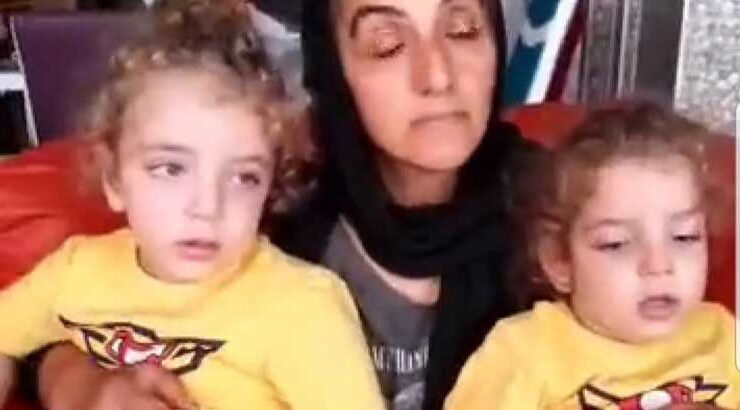 Siyam İkizlerin Hayata Tutunma Mücadeleleri Yarım Kaldı!